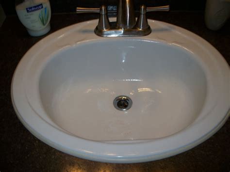 At some point, you will lose sleep over the sound of incessant dripping. Bathroom sink leaking