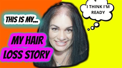Who S June Penny My Hair Loss Story Why I Have Balding Hair Youtube