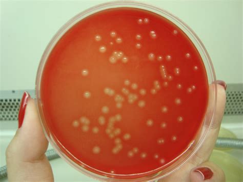 Streptococcus Agalactiae El Médico Interactivo