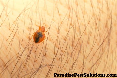 Maybe you would like to learn more about one of these? Can Bed Bugs Live in Your Hair?