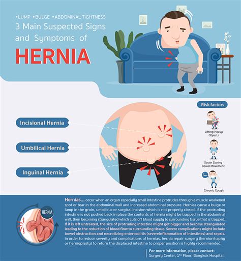 Abdominal Strain Or Hernia Pulled Abdominal Muscle Symptoms And