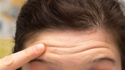 6 causes of forehead wrinkles + your wrinkle type. Check Out What You Need To Know To Avoid Forehead Wrinkles