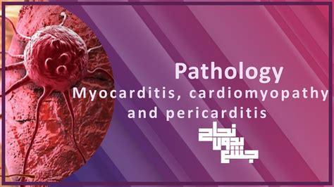 Revision Of L6 Myocardial Pericardial Disease Pathology Youtube