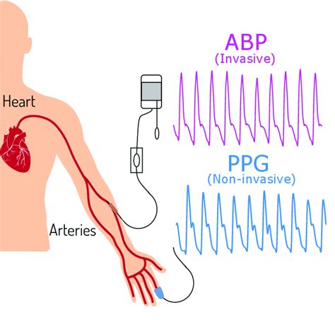 Simultaneously Collected Arterial Blood Pressure Abp And