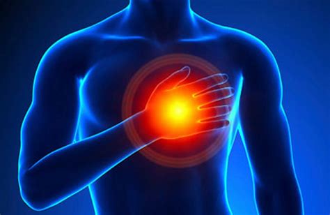 Chest Pain Follow Up Linked To Better Survival Heart Health Finesse