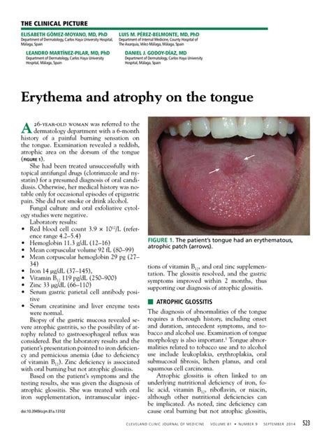 Erythema And Atrophy On The Tongue Cleveland Clinic Journal Of Medicine