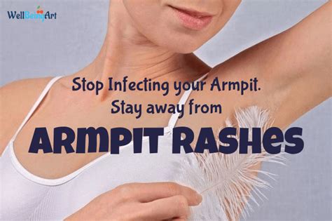 Frequent Signs Of An Armpit Rashes Embrace Itching Small Bumps On The Pores And Skin Darkening