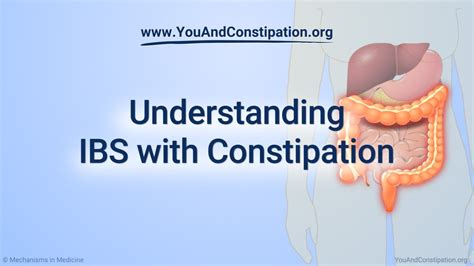 Understanding Ibs With Constipation Youtube
