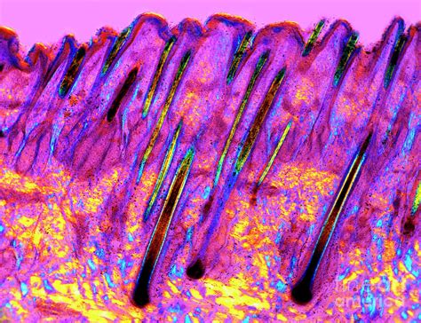 Human Skin Photograph By Dr Keith Wheelerscience Photo Library