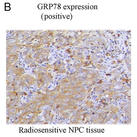 analysis of the grp78 expression in npc and chronic rhinitis tissues download scientific