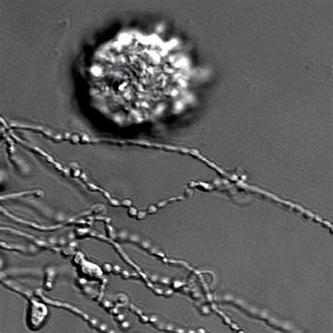 Dying White Blood Cells Can Be Seen Communicating As Scientists Make