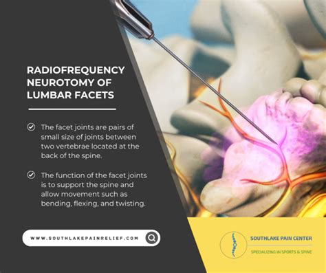 Radiofrequency Neurotomy Of Lumbar Facet Treatment In Southlake Tx