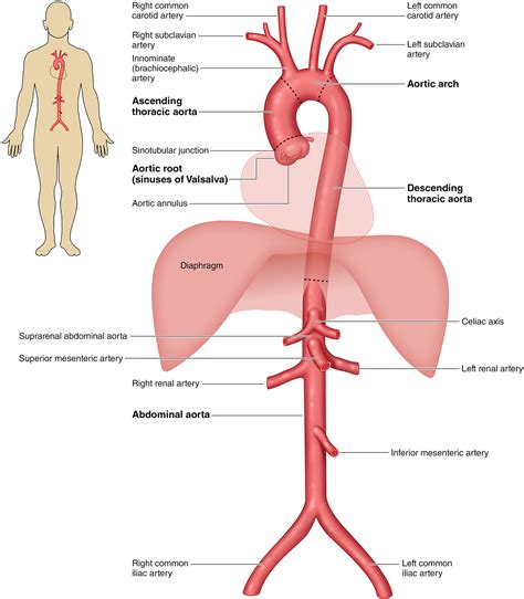 2022 ACC/AHA Guideline for the Diagnosis and Management of Aortic