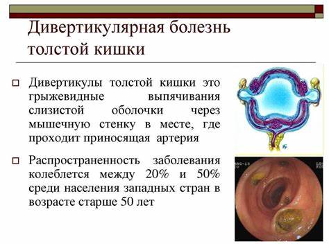 Дивертикулит диета толстой кишки лечение Дивертикулит Сигмовидной Кишки Лечение Диета — Похудение Диета Дивертикулит Сигмовидной Кишки Лечение Диета — Похудение Диета Дивертикулит диета толстой кишки лечение