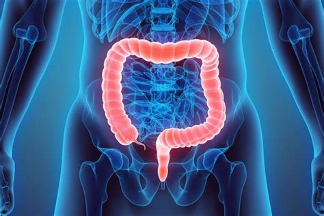 Ulcerative Colitis Colorectal Surgeons Long Island Ny