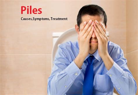 Hemorrhoids Piles Symptoms Causes And Treatments