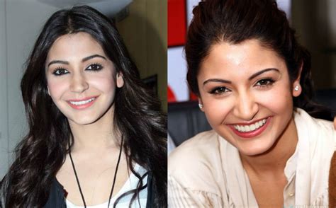 15 Bollywood Actresses Became Unidentifiable After Plastic Surgery