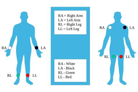 This is an online quiz called 12 lead ecg placement. The Ultimate 12-Lead ECG Placement Guide (With Illustrations)