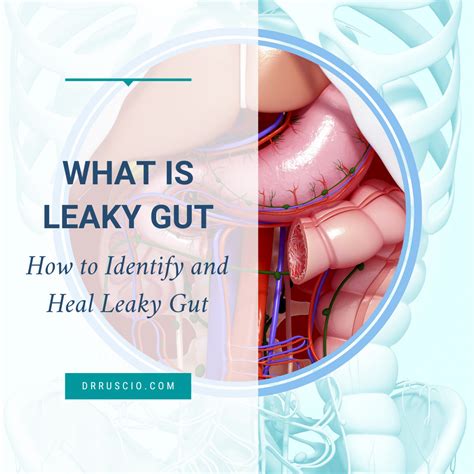 What Is Leaky Gut Dr Michael Ruscio DC