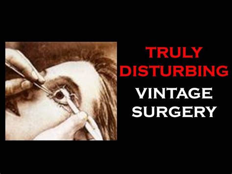 Truly Disturbing Vintage Surgery Youtube
