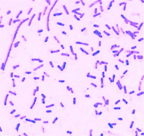 Gram Staining Showing Subterminal Spore In Gram Positive Bacilli