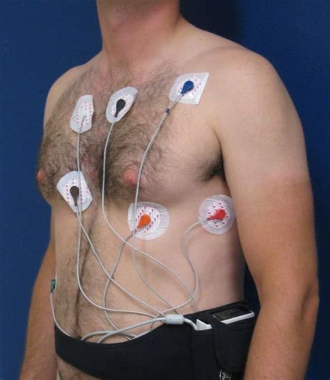 Holter Ecgpedia