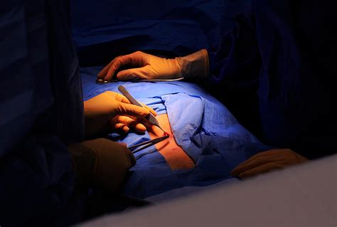 Scarless Hernia Repar Operating Room Sayegh Surgery