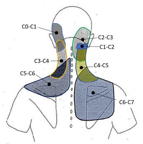 Whats The Purpose Of A Neck Facet Injection Regenexx