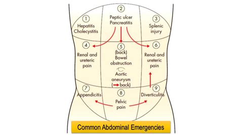 Approach To Acute Abdominal Pain In Emergency Ward