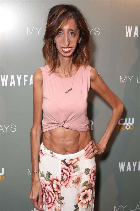 Lizzie Velasquez Shares Her Best Advice For Standing Up To Bullying