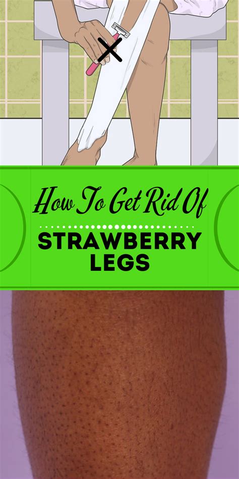How To Get Rid Of Strawberry Legs Strawberry Legs