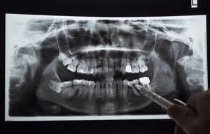 Tramadol good for toothache card cannot afford. Digital X-Rays | Intra-Oral Camera | Laith Family Dentistry