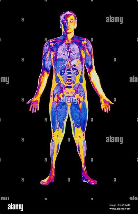 Male Body Sectioned Computer Coloured Front View Of The Male Human