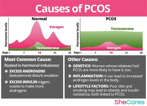 Pcos Polycystic Ovary Syndrome Shecares