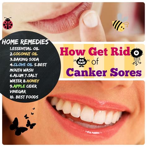 Put some honey on the affected area on your tongue and leave for a few minutes. #10 Home Remedies for Canker Sores: Happy Lips