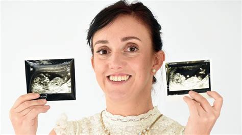 I Was Born With Two Vaginas News Com Au Australias Leading News Site