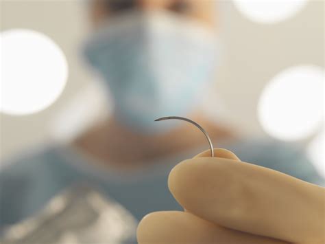 How To Care For Dissolvable Stitches