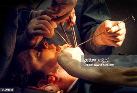 Incision Surgery Photos And Premium High Res Pictures Getty Images