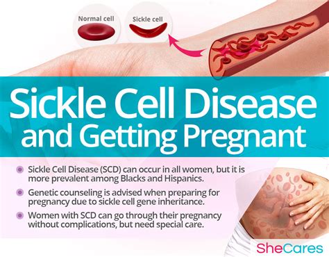 Sickle Cell Disease In Pregnancy Women With Sickle Cell Disease Carry