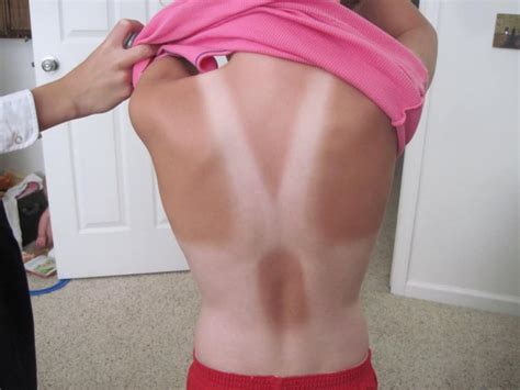20 Shocking Tan Lines You Ll Have To See To Believe
