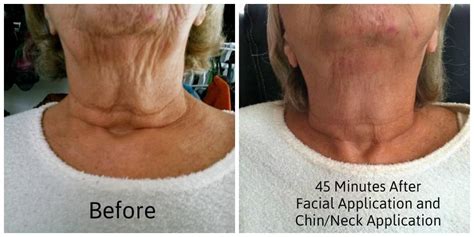 Wrap Your Neck Get Rid Of Loose Skin And Wrinkles Wraps By Hayley