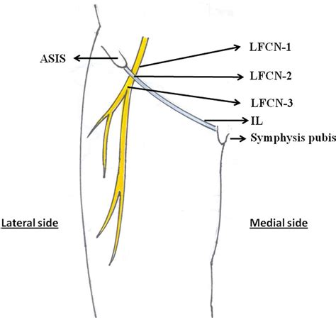 Scielo Brasil Microanatomy Of The Lateral Femoral Cutaneous Nerve