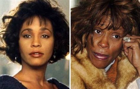 Horrible 18 Shocking Photos Of Famous Celebrities Before And After