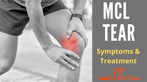 Medial Collateral Ligament Mcl Tear Symptoms Treatment Exercises My
