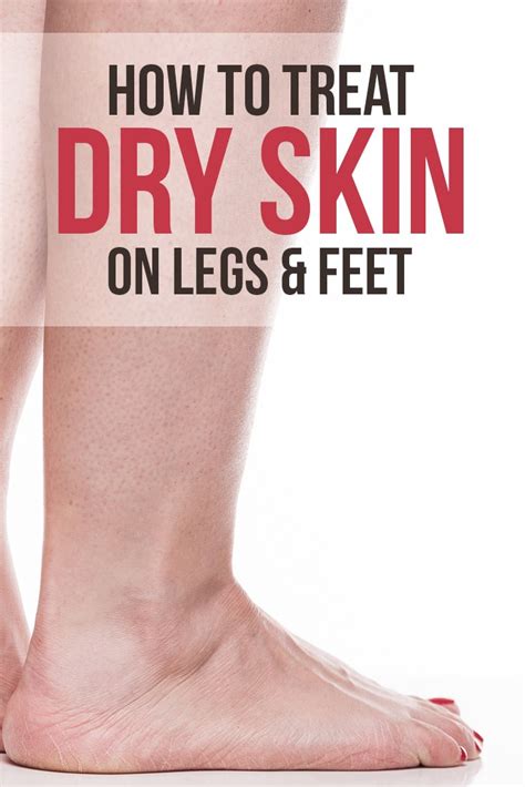 So having dry legs isn't always something we can prevent, but it is treatable with the right methods and products. What Causes & How to Treat Dry Skin on Legs : Skin Care Tips