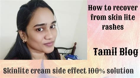 Skin Lite Cream Side Effect 100 Solution Reveal Must Watch 😊 Youtube