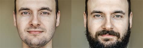 Beard Growth Stages By Age
