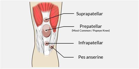 The shoulder has several other important structures: Bursitis Knee - The Complete Injury Guide - Vive Health