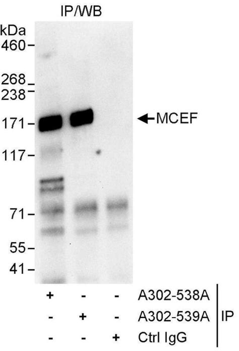 Mcef Polyclonal Antibody A302 538a