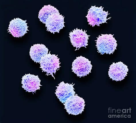 T Lymphocytes Photograph By Steve Gschmeissnerscience Photo Library
